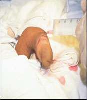 ������� �������