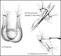 ���������� - ������������� ������������ ��� ������