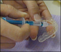 ������ ������ �����