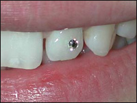 ������ ��������� ������