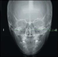 ������� ������������ �������� J.Morita: ������ ����� ���������� �������� ������������� ���������