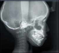 ������� ������������ �������� J.Morita: ������ ����� ���������� �������� ������������� ���������