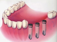 ����������� ����� � ������� ������ �� ����������