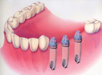 ����������� ����� � ������� ������ �� ����������