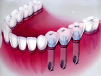 ����������� ����� � ������� ������ �� ����������