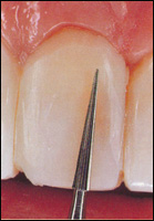 �������������� ���� Kerr Have ��� ������������� ������� ������ ����� � ����������� �����