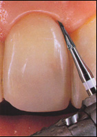 �������������� ���� Kerr Have ��� ������������� ������� ������ ����� � ����������� �����