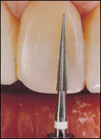 �������������� ���� Kerr Have ��� ������������� ������� ������ ����� � ����������� �����