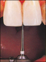 �������������� ���� Kerr Have ��� ������������� ������� ������ ����� � ����������� �����