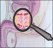 ����������� ���������