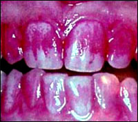 ������� ��� ������������ ���������