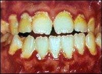 ������� ��� ������������ ���������