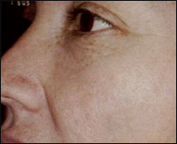 �������� ���������� ���������� ����