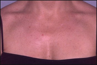 �������� ���������� ���������� ����