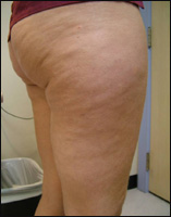 ��������. ��������������� ������� ��������� � �������� �������������