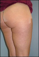 ��������. ��������������� ������� ��������� � �������� �������������