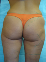 ��������. ��������������� ������� ��������� � �������� �������������