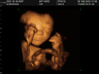 3D/4D ��� � ���������� ���������