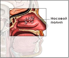 ������ ����� � ����� ������