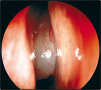 ������ ����� � ����� ������