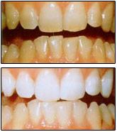 ������ �� �������