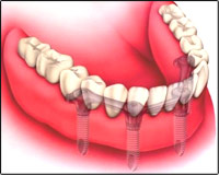 ��������. ���� �������� �����������