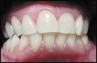 �������� ���. ��� ������ � ������������?