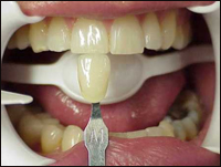 �� �� �� ����� ���� �����? ��� �������� ����?