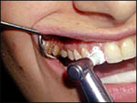 ��� ������ ����������