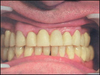 ��� ������ ����������