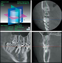 ����������������� ������������ �������� 3 DX Accuitomo / FPD ������������ XXI ����