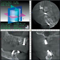 ����������������� ������������ �������� 3 DX Accuitomo / FPD ������������ XXI ����