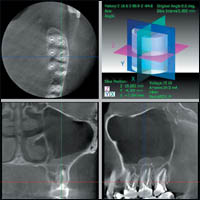 ����������������� ������������ �������� 3 DX Accuitomo / FPD ������������ XXI ����