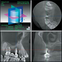 ����������������� ������������ �������� 3 DX Accuitomo / FPD ������������ XXI ����