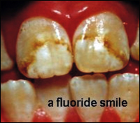 �������� ���������� ������ ����